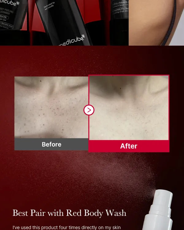 Red Acne Body Peeling Shot