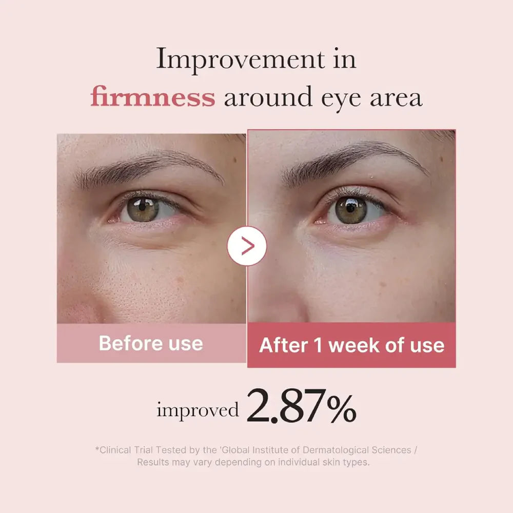 medicube - pdrn pink peptide eye cream